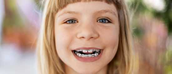 Zahnzusatzversicherung mit Kieferorthopädie für Kinder